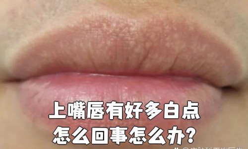 经期可以吃西梅水果吗-经期可以吃西梅不、列假可以吃西梅吗 -经期能吃法国西梅吗网